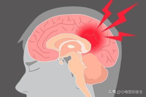 高血压最可怕的11个并发症，管理好血压是最好的预防方法。