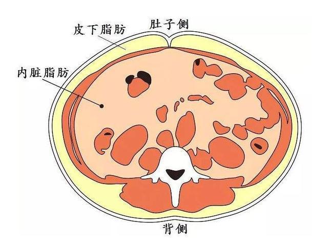 内脏脂肪有多大的危害？减掉它们并不难