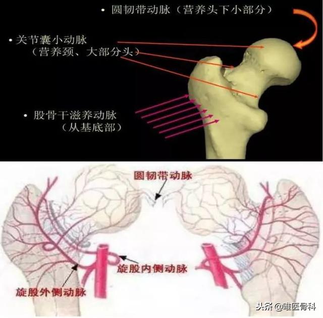 这是老年人最怕的骨折，一定要重视！