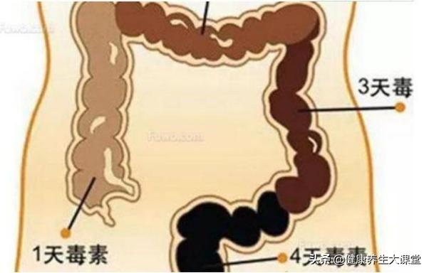 体内毒素多的人，会有这4个表现，若占3个以上，就要给身体排毒了