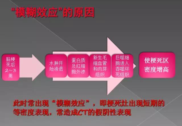 缺血性、出血性、分水岭、腔隙性四大类脑梗的影像区别