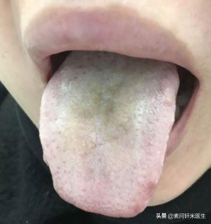 阳气不足是导致肿瘤等恶性疾病的根本原因！趁着春天该怎么补阳？