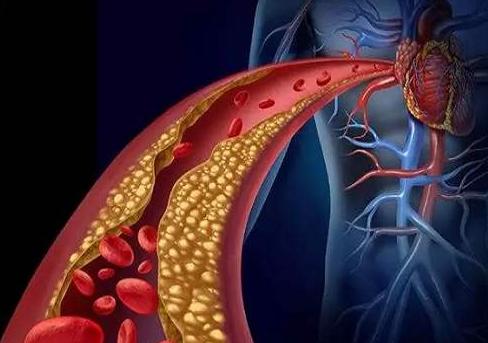 胆固醇越低越好？这些年胆固醇蒙受的“不白之冤”