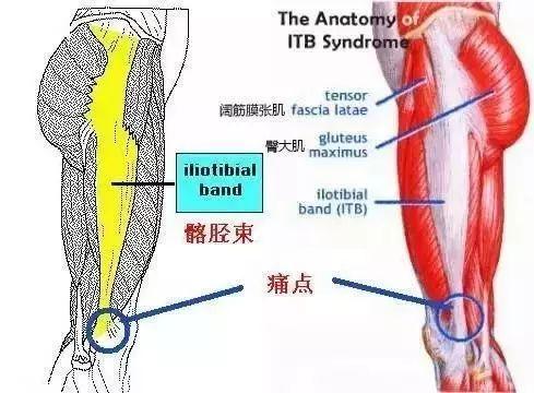 不保护好膝关节，小心你跑的步都白跑了