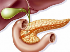身体的这些异常症状很可能就是胰腺癌