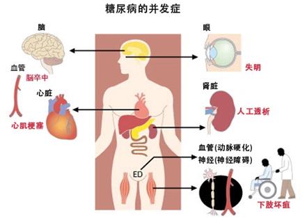 为什么这么多中国人发生糖尿病？糖尿病有哪些危害？医生讲清楚了