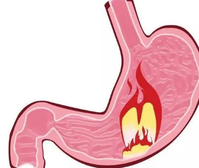 消化科主任：身体出现2种情况，怕是胃病“恶化”，别忽视