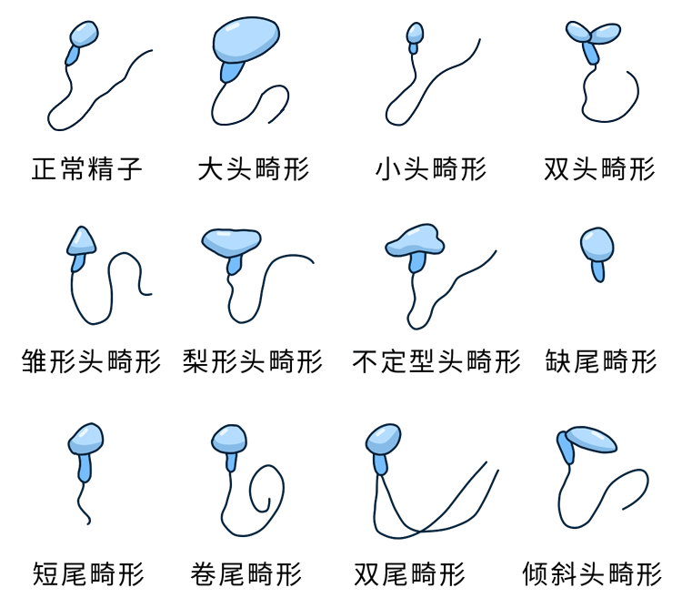 男性的“精液”健不健康，通常看这4点能知道，自己要多点关心