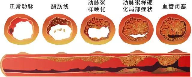 进入老年的你，若还能保持“4个健康”，有长寿潜质，值得恭喜